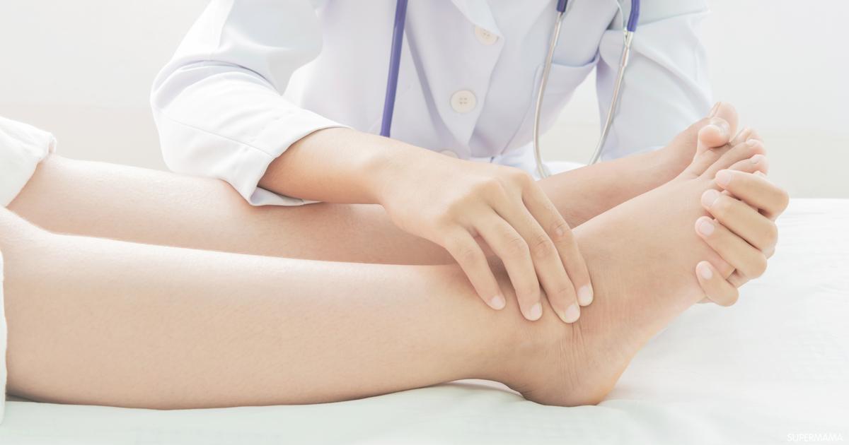 11 سبب لتورم القدمين سوبر ماما